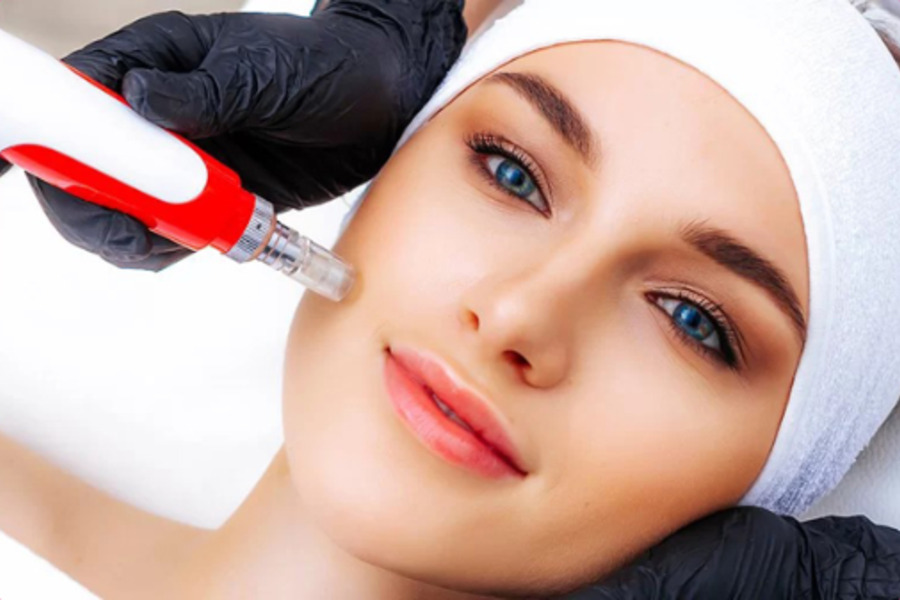 Curso de Dermapen